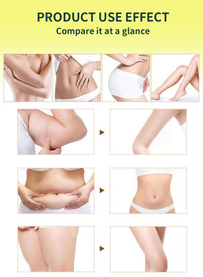 Extractos e Essências de Ervas Para Perda de Peso Creme Lumbar Infusão de Cúrcuma para Queimador de Gordura