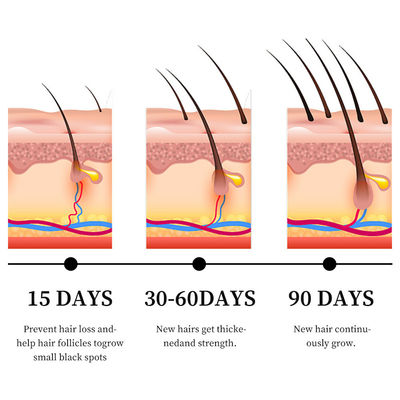 Potente soro anti-caída de cabelo com óleo de gengibre e vitamina B5