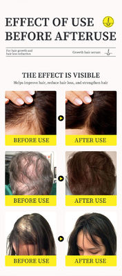 Potente soro anti-caída de cabelo com óleo de gengibre e vitamina B5